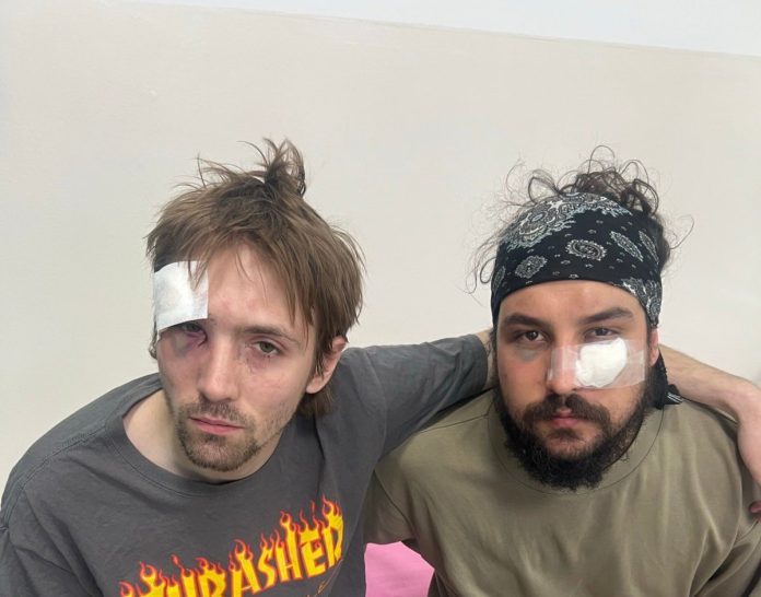 nasilje nad novinarima