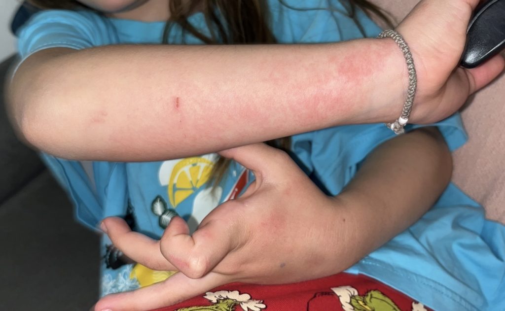 Deca peru ruke u vrtiću – problem sa sapunom izaziva iritaciju kože